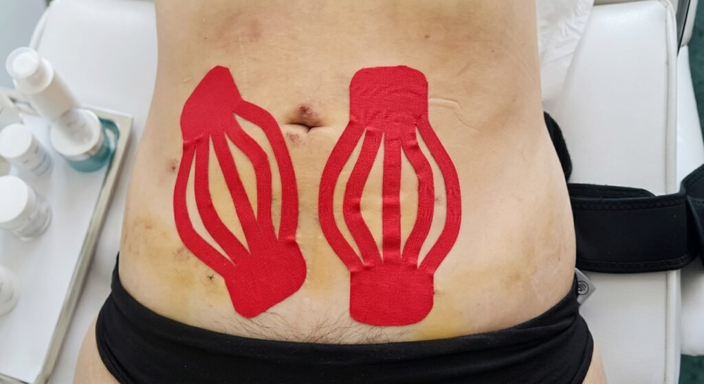 Tratamiento de Fibrosis Postquirúrgica